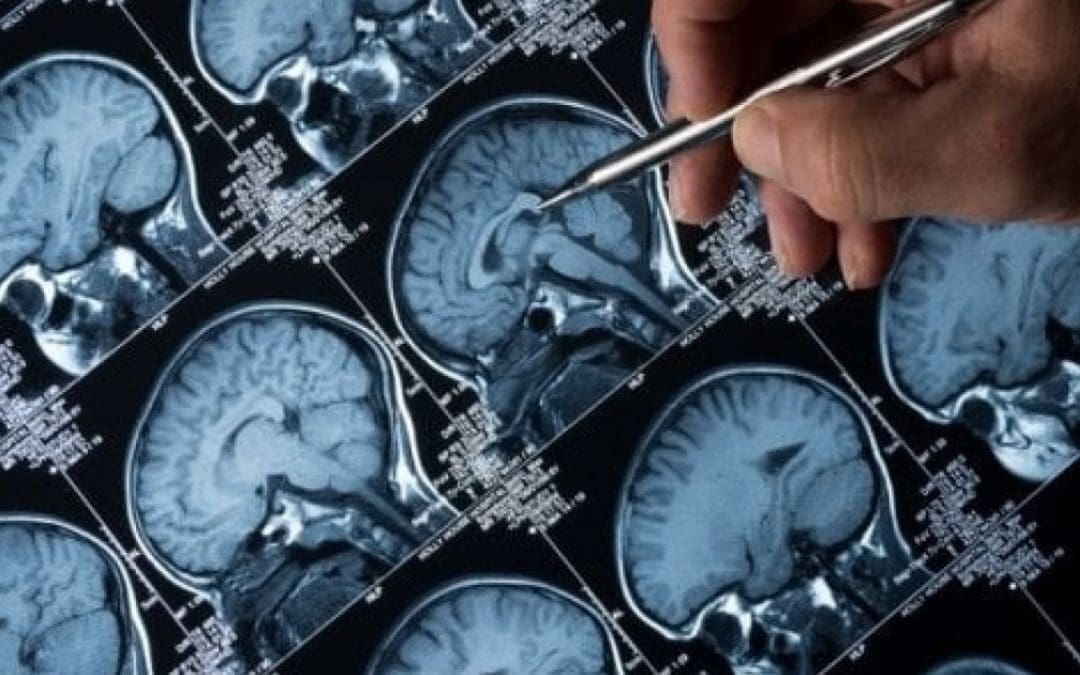 L’utilizzo della tecnologia ha comportato risultati positivi in diverse sperimentazioni condotte su animali. Nel 2019 è in programma un test sugli esseri umani