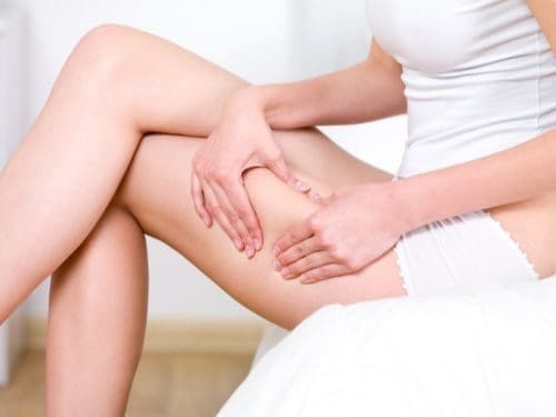Cellulite gamba donna