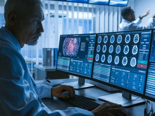 Scopri le ultime ricerche che riguardano i rimedi più validi per trattare il Morbo di Parkinson Medico analizza ricerche sul cervello