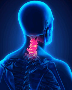 artrosi cervicale sintomi