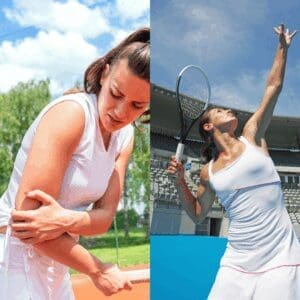 gomito del tennista risultati terapia