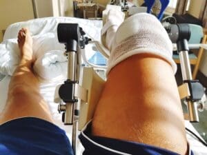 terapia ginocchio post-operatorio