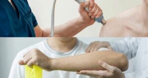 Trattamento ultrasuoni per infiammazione tendinea