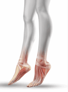 ultrasuoni per fascia plantare