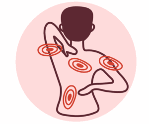 Campi di applicazione più utilizzati: Riduzione di infiammazioni
